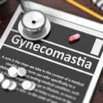 Feeling Confident When You Suffer from Gynecomastia