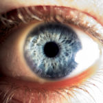 Treating Graves’ Eye Disease the Natural Way