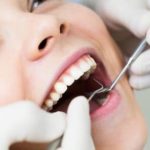 The Scoop: Cavity Fillings