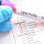 Why Is a Lipid Profile Test Necessary to Keep Heart Diseases at Bay?