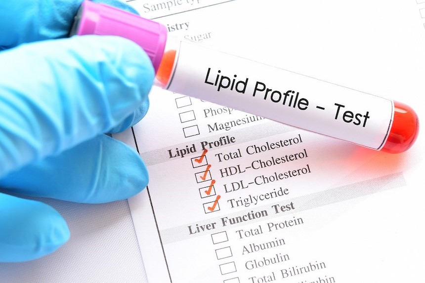 lipid-profile-test-doctors-journal-anne-cohen-writes