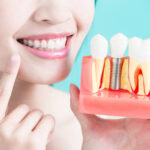 Dental Implant or Crown? How To Choose Which Is Right for You