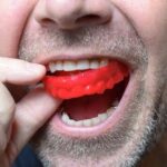 Teeth Grinding: The Dangers, Causes, and Solutions