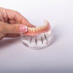 When a Dental Implant Is the Best Option